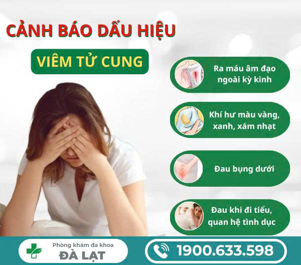 Hình ảnh minh họa